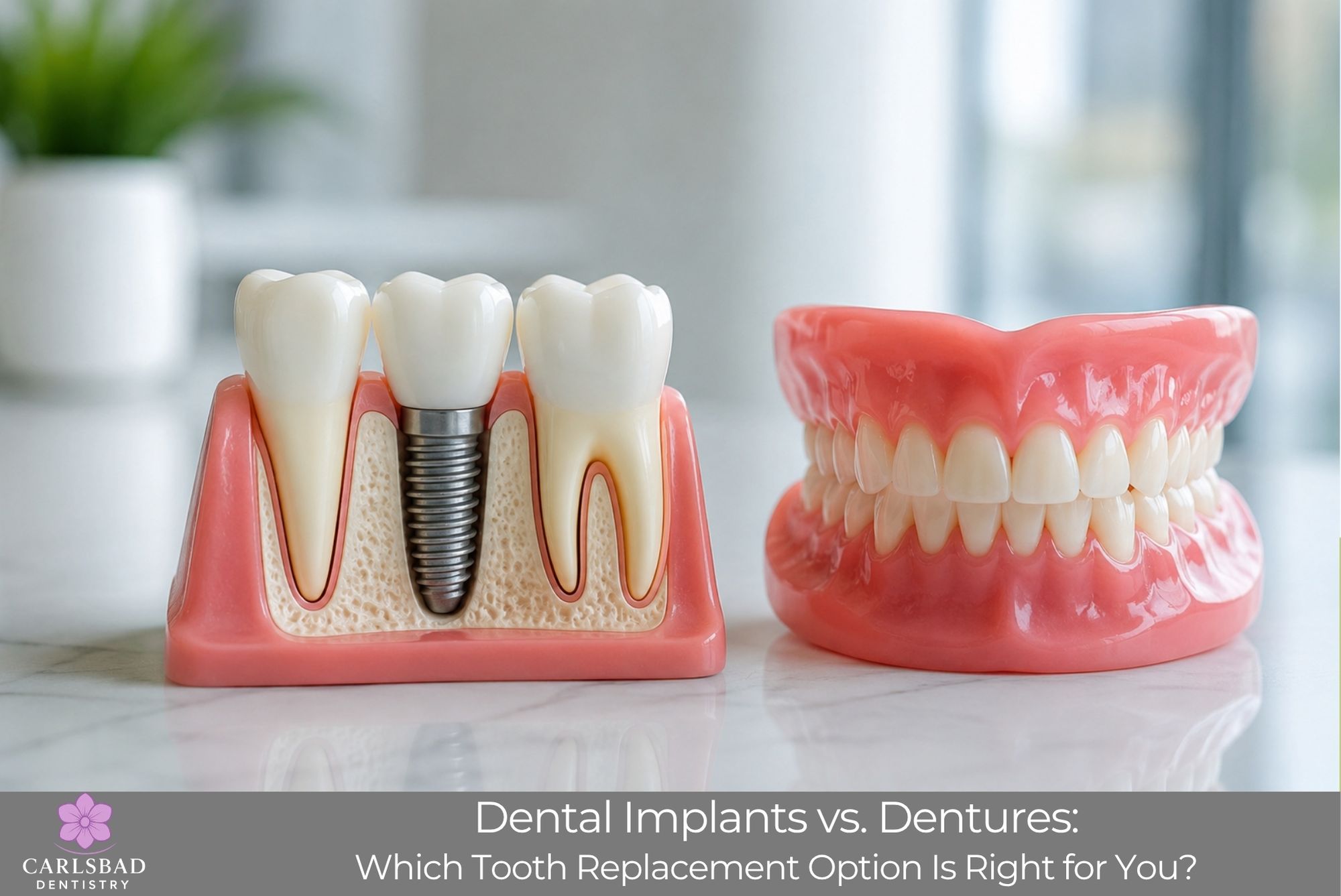 Dental Implants vs. Dentures: Which Tooth Replacement Option Is Right for You?